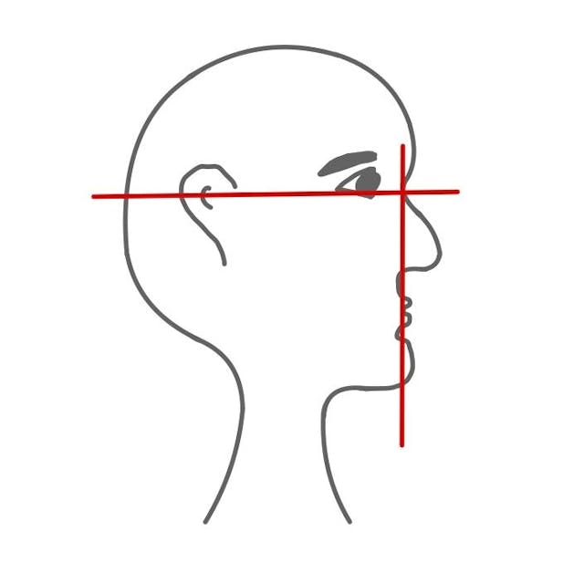 Dazu gehören zum einen die Stirn-, Nasen-, Lippen-, Kinnform und zum anderen kann die Nasensenkrechte (Linie senkrecht von der Nasenwurzel herunter) und die Frankfurter Horizontale (zwischen Nasenwurzel und Ohr) eingezeichnet werden.