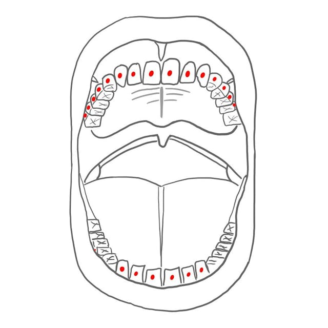 vestibulär (v)   =   zum Mundvorhof hin 

- alle Zähne 
