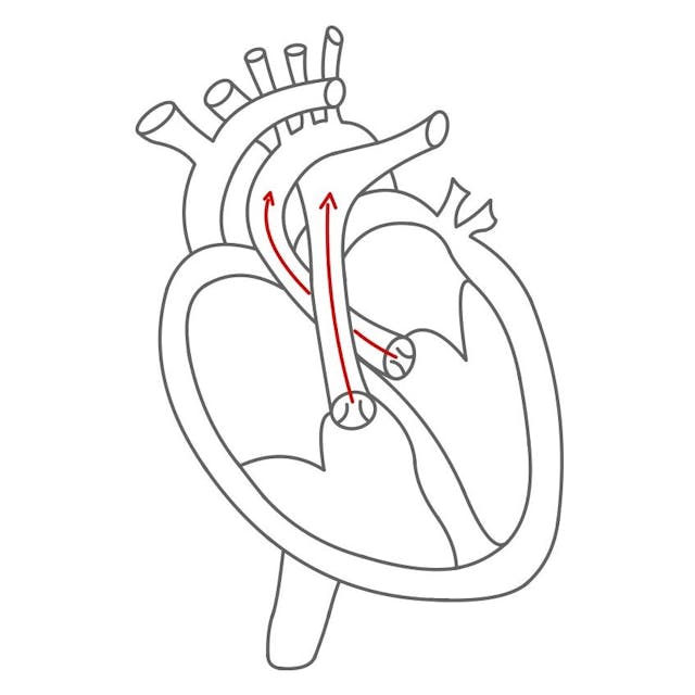 Die Taschenklappen öffnen sich, wenn der Druck zu groß wird. 

Das Blut wird über die Lungenarterie (rechts) und die Aorta (links) heraus gepumpt. 