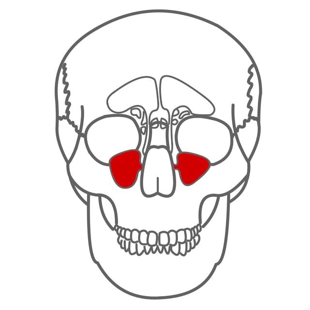 Kieferhöhle (sinus maxillaris)