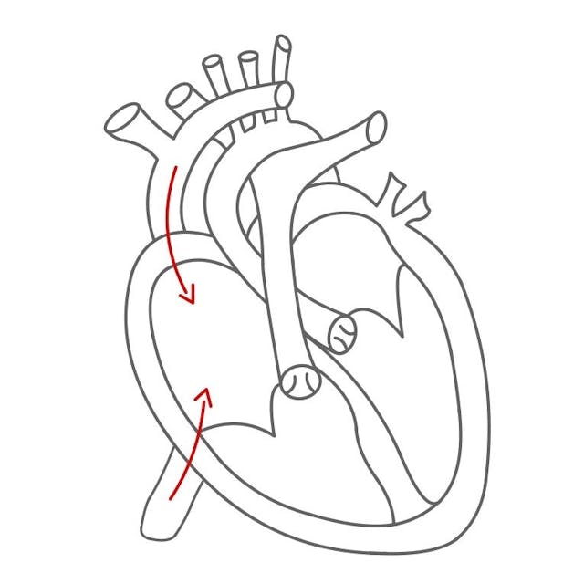 Rechte Herzhälfte:

sauerstoffarmes Blut kommt über die obere und untere Hohlvene in den rechten Vorhof. 