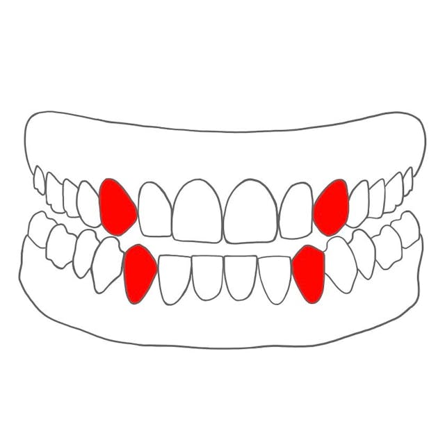 Eckzahn (Caninus)

Welche Zähne: 3er
Aussehen: scharf & spitz
Aufgaben: festhalten & zerreißen von Essen