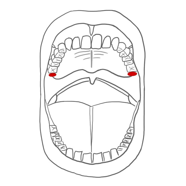 Im hinteren Bereich des Alveolarfortsatzes befinden sich runde Knochenhöcker (Tuber maxillae). 