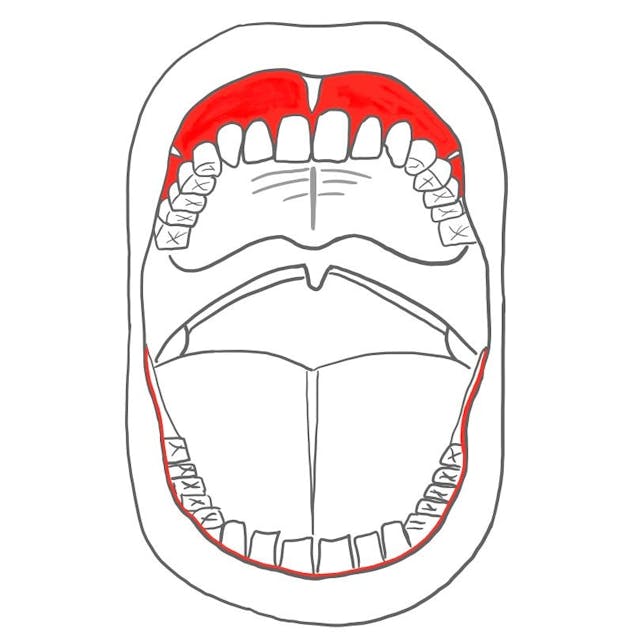 Der Mundvorhof (vestibulum oris) befindet sich zwischen den Kieferfortsätzen und Wange / Lippe. 

