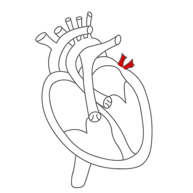 Auf der linken Herzseite kommt Blut durch die Lungenvene in den Herzvorhof. 