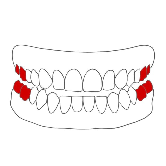 3 Wurzelkanäle:
16/17,
26/27,
36/37,
46/47