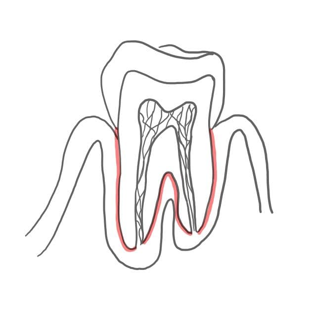 Wurzelzement (Cementum):