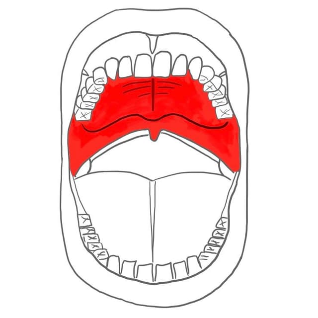mittlere Gaumenfalte = raphe palati
quere Gaumenfalte = plica palatina transversa