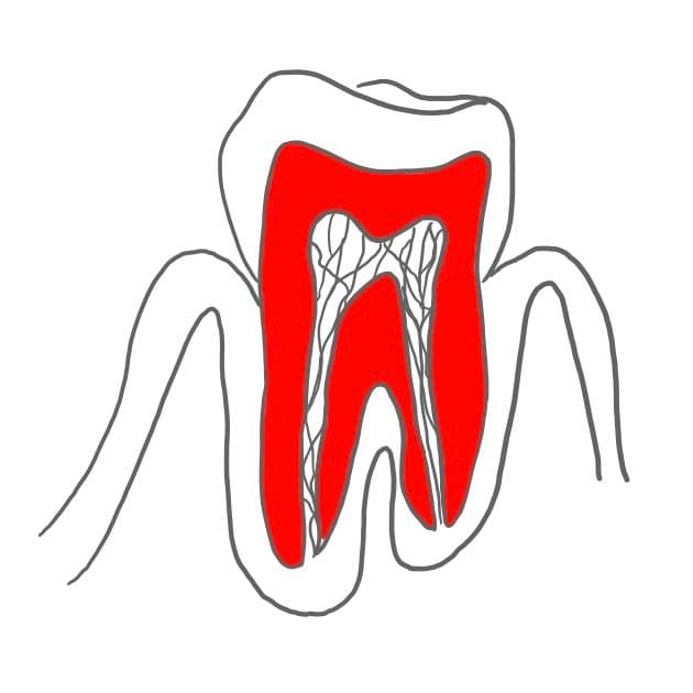 Zahnbein (Dentin):
