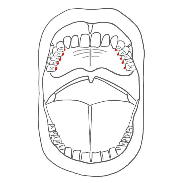 palatinal (p) = zum Gaumen hin
- alle Innenflächen, nur Oberkiefer (OK)