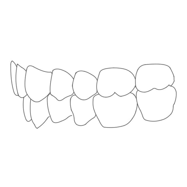 Insgesamt greift der Oberkiefer nach außen etwas über den Unterkiefer.