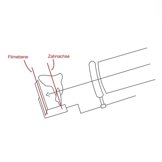 Die Film- und Zahnachse sind bei dieser Technik parallel zueinander.