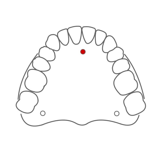 Foramen incisivum:
hinter den Schneidezähnen.