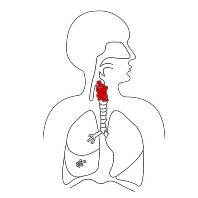 Vom Rachen (Pharynx) geht es weiter über den Kehlkopf (Larynx) und die Stimmbänder zum Kehlkopfdeckel (Epiglottis).