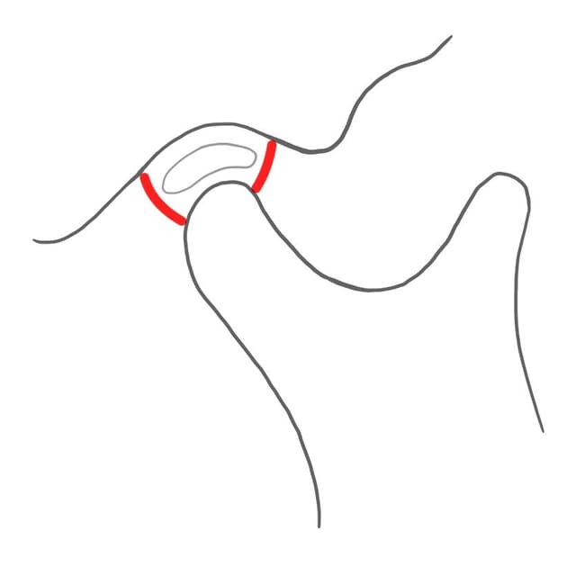 Das ganze ist von einer Gelenkkapsel (capsula articularis) luftdicht überzogen.