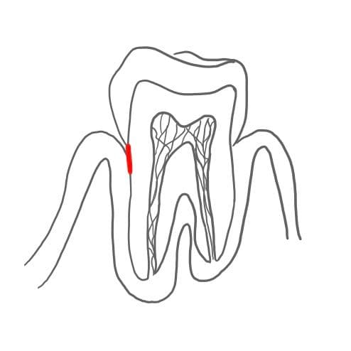 Sie breitet sich flach und ringförmig um die Wurzel aus.
