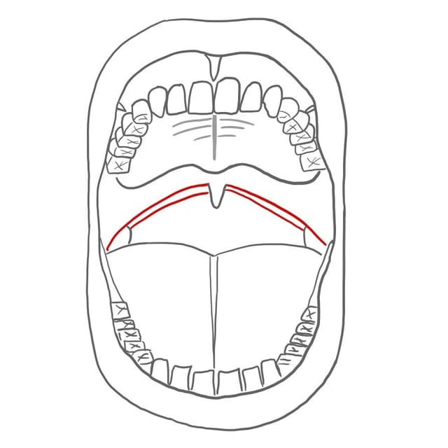 Gaumenbogen = arcus palati
Gaumenhügel = torus palatinus