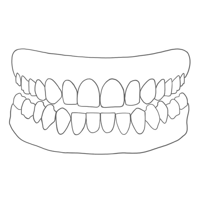 Einem Oberkiefer (Maxilla) und einem Unterkiefer (Mandibula).