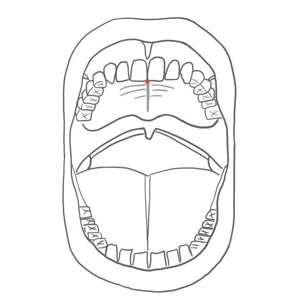 Schneidezahnpapille = papilla incisiva