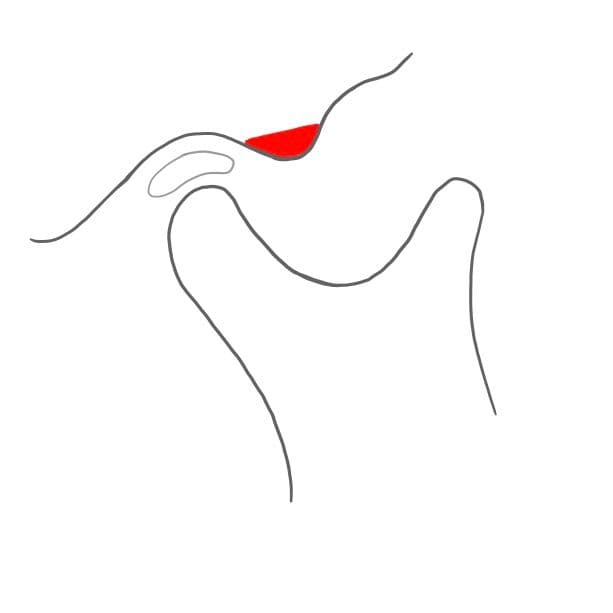 Vor der Gelenkpfanne ist der Gelenkhöcker (tuberculum articulare).