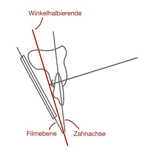 Hierbei muss man sich eine Winkelhalbierende zwischen der Zahnachse und der Filmebene denken.