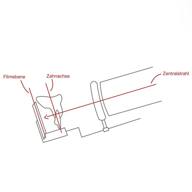 Der Zentralstrahl wird senkrecht zur Zahnachse und Filmebene eingestellt.