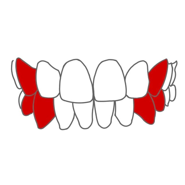 Die Spitze der oberen 3er (13, 23) zeigt zwischen die unteren 3er & 4er.