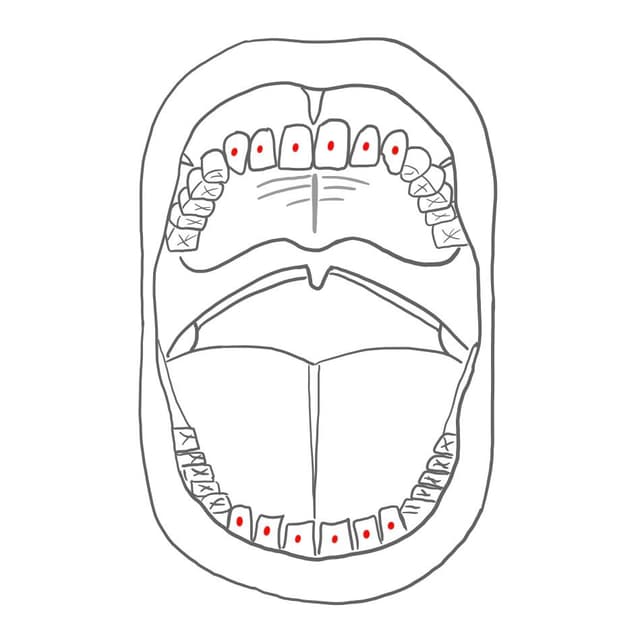 labial (la / v) = zur Lippe hin
- nur im Frontzahnbereich (FZB)