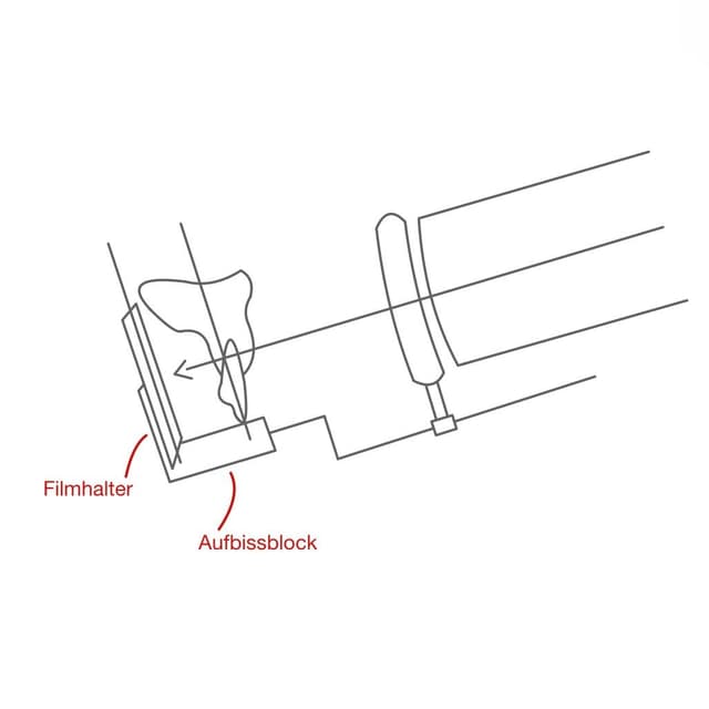 Die Patienten können dabei auf einen Aufbissblock beißen und so den Filmhalter festhalten.
