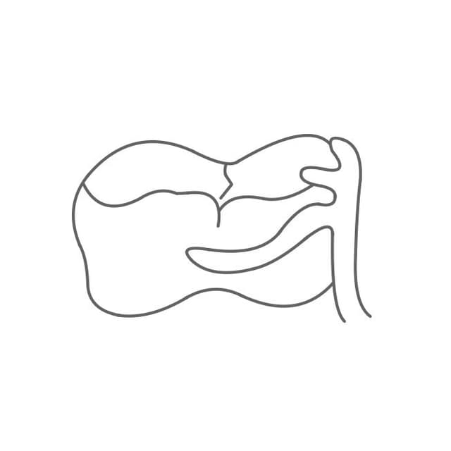 Klammern (Halte- & Stützelemente):
für die Interimsprothese werden gebogene und für Modellgussprothese gegossene (nicht bewegliche) Klammern genutzt.