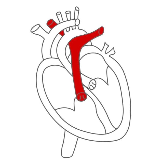 Über die Trikuspidalklappe kommt das Blut in die Kammer.
Mit niedrigen Druck wird das Blut durch die Pulmonalklappe und über die Lungenarterie in die Lunge gepumpt.