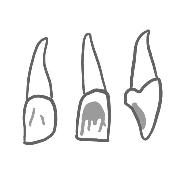 Von der Seite schauen die Schneidezähne schaufelförmig aus.